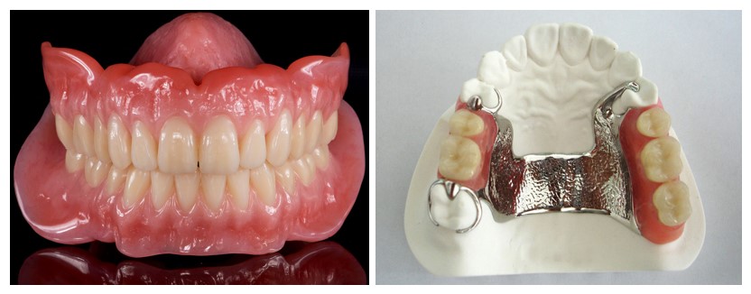 PROSTHETIC DENTISTRY