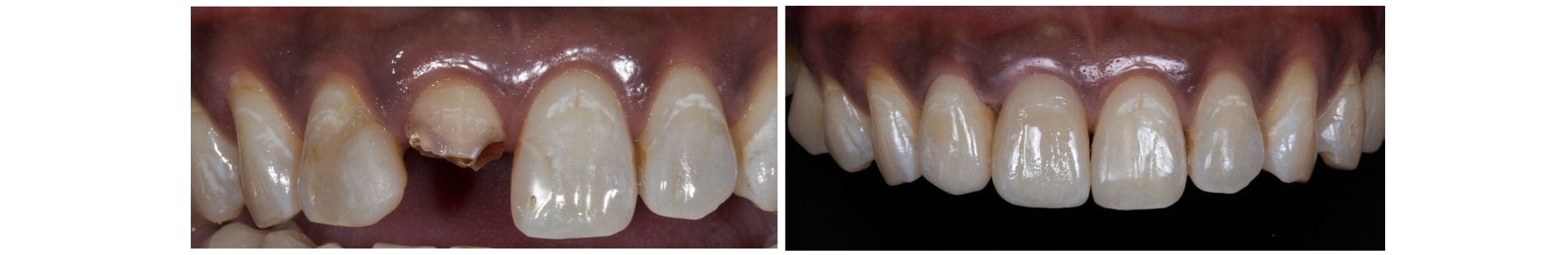 INTEGRATED RESTORATIVE DENTISTRY